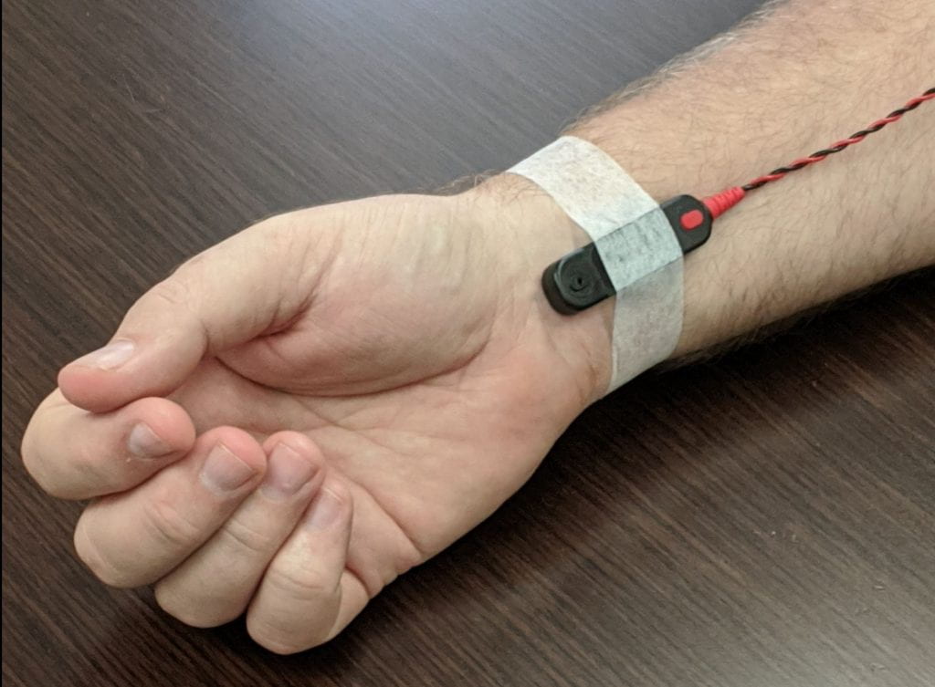 Stimulating electrode at the wrist
