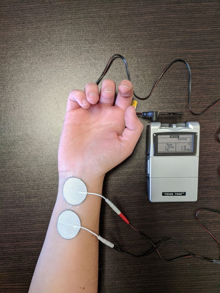 Setting up the TENS device for median nerve stimulation